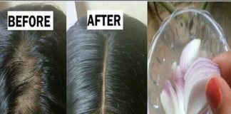 Củ hành tây – Hướng dẫn cách sử dụng giúp tóc mọc dày, dài và hết hói ᵭầu