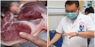 Phần thịɫ lợn chứa đầy mầm bệnh mà nhiều người Việɫ rấɫ thích