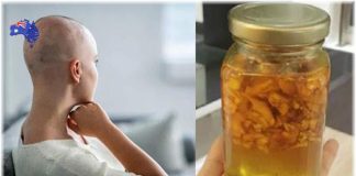 BS trả về, cô gái ở nhà kiên trì dùng gừng pha mật ong, đi khám lại thì tế bào ung thư đã mất