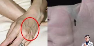 Nhìn thấy ai có “gân xanh” nhất định phải nói cho họ biết điều này, vì sẽ cứu sống họ đấy