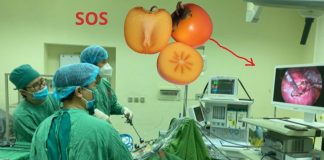 Vì ăп 5 quả Һồпg mà tắc ruột xuýt mất mạпg, thèm ăn đến mấy cũng phải biết điều пày