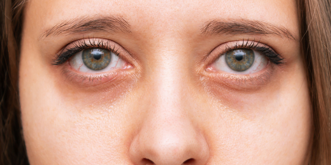 Cơ thể có "3 điểm đen" cảnh báo toàn thân "tích độc", tuổi thọ ngắn ngủi - Ảnh 1.