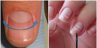 10 biểu hiện lạ trên móng tay cảnh báo bệnh tật: Xuất hiện các vệt trắng, sọc dọc