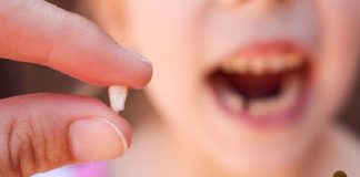 Đừng vứt răng sữa vì chúng có thể cứu trẻ trong tương lai, BS nói cách nhổ răng sữa chuẩn