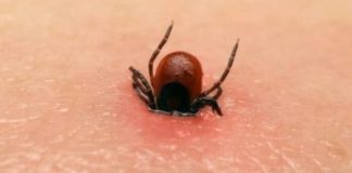 Ve chó cắn 3 người trong một gia đình, 2 người qua đời: Không vệ sinh được thì đừng nuôi, đầy bệnh