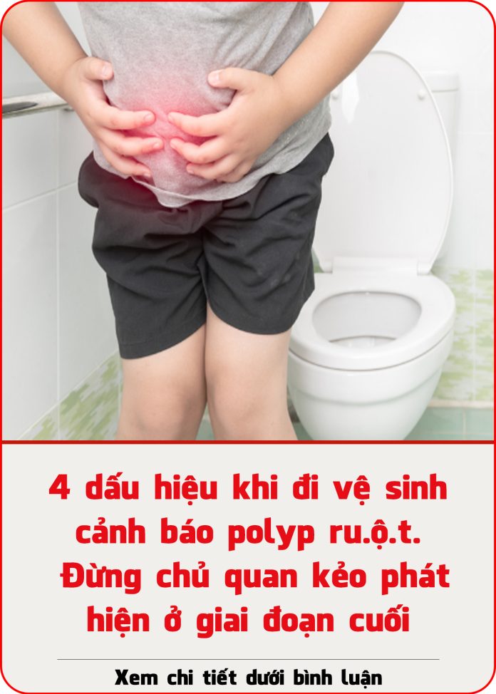 4 dấu hiệu khi đi vệ sinh cảnh báo polyp ruột