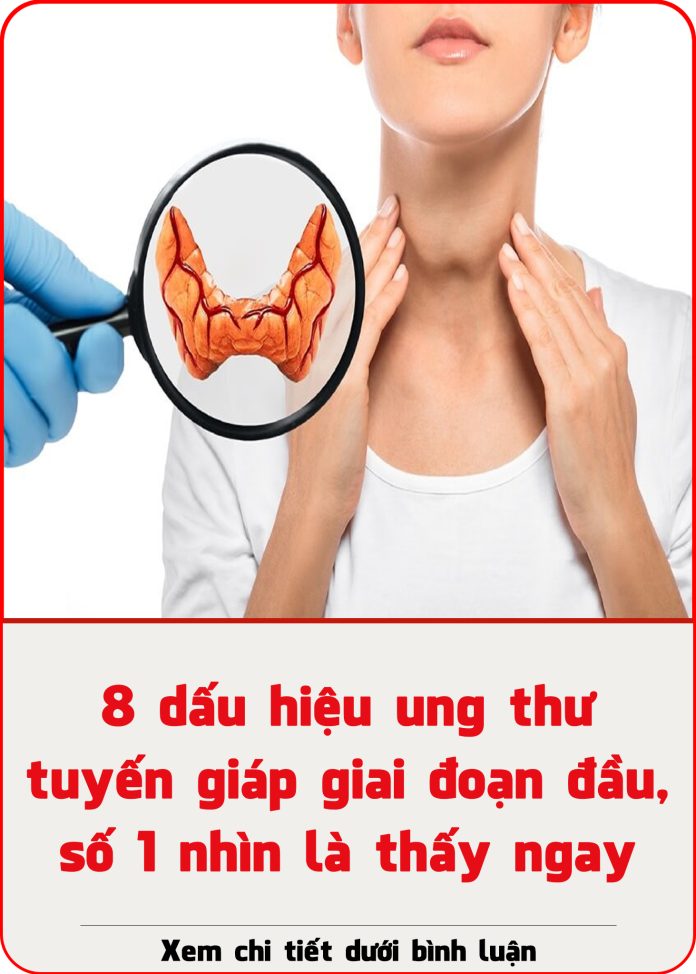 8-dau-hieu-ung-thu-tuyen-giap-giai-doan-dau-so-1-nhin-la-thay-ngay