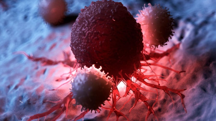 4 loại ung thư có cơ hội được chữa khỏi trên 90%: Ai cũng nên để ý dấu hiệu sớm