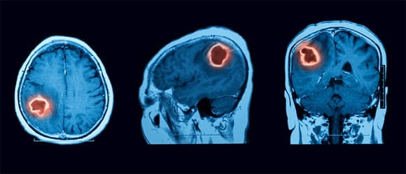 U não, diễn viên quý bình, sức khỏe