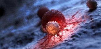 Nếu bạn không thực hiện 5 cuộc kiểm tra sức khỏe này, bạn sẽ không biết mình bị UT ! Tốt nhất là nên kiểm tra những bộ phận này thường xuyên