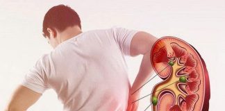 5 dấu hiệu suy thận giai đoạn đầu cần biết: Số 3 nhiều người bị nhưng phớt lờ