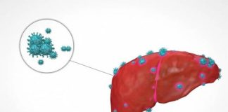 Phải mất bao nhiêu năm từ khi bị viêm gan B đến UT g:an? Lời nhắc nhở: Nắm bắt bốn tín hiệu UT và phanh kịp thời