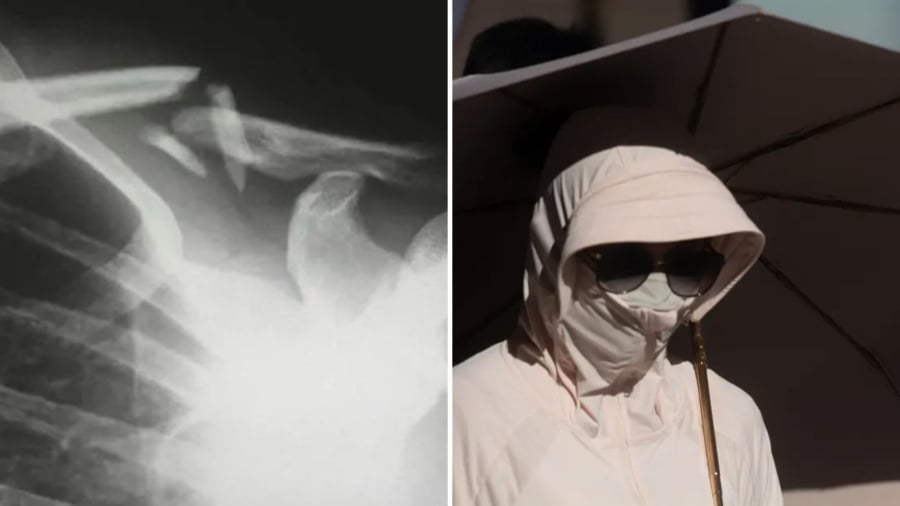 gay-xuong-do-che-nang