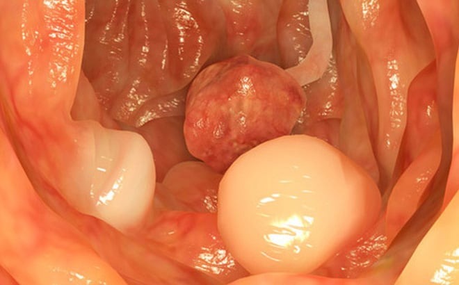 photo-1-1497340305129-1499740753