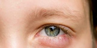 4 dấu hiệu bất thường ở đôi mắt cảnh báo u-ng thư mà nhiều người thường bỏ qua