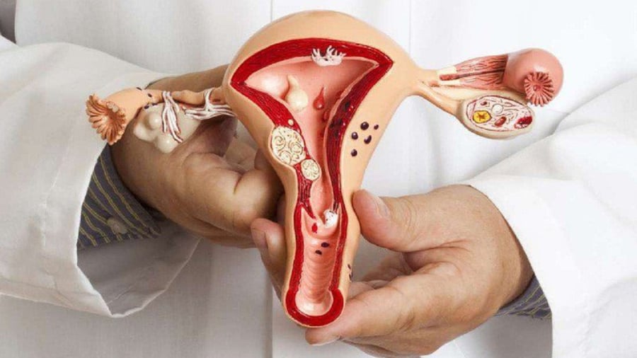 ung-thu-co-tu-cung-ti-le-song-va-phuong-phap-dieu-tri-1