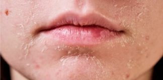 4 dấu hiệu thay đổi trên khuôn mặt cảnh báo u:n;g thư cổ t;ử cung, phụ nữ cần lưu ý ngay