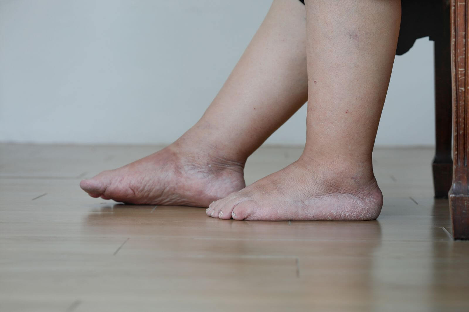 Khi gan suy nặng, cơ thể sẽ sưng ở 5 chỗ: Có 1 cũng nên đi khám ngay- Ảnh 1.