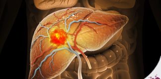 U:n;g thư gan rất “sợ” 7 loại thực phẩm này: Người trẻ càng nên chú ý