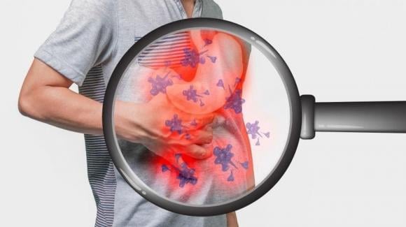 Ung thư tụy được gọi là “vua của các ung thư” vì tiến triển nhanh và khó phát hiện. 