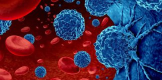 Cảnh báo 2 thực phẩm “châm ngòi” mạnh nhất cho UT