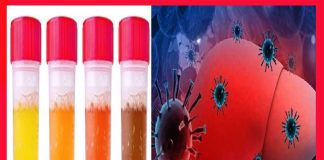 Sáng dậy thấy 4 thứ này sợ rằng gan đã “rỗ như tổ ong”