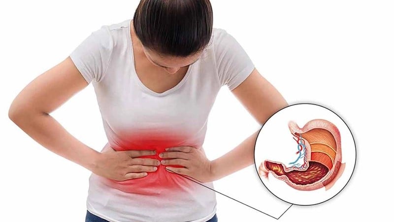 Dấu hiệu cảnh báo bệnh đau dạ dày