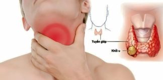 7 dấu hiệu sớm của K tuyến giáp, nhiều người chủ quan bỏ qua