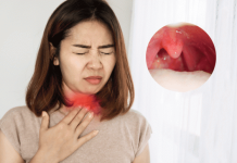 Cảnh báo: Khi thấy cơ thể có dấu hiệu này phải tới bệnh viện ngay kẻo u:ng th:ư vòm họng giai đoạn cuối
