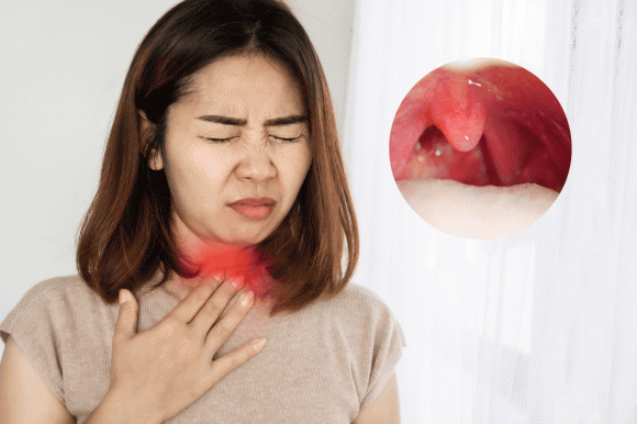 Cảnh báo: Khi thấy cơ thể có dấu hiệu này phải tới bệnh viện ngay kẻo u:ng th:ư vòm họng giai đoạn cuối
