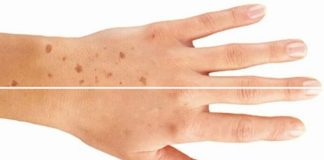 Mu bàn tay tiết lộ bí mật sống thọ: 4 dấu hiệu ai cũng nên kiểm tra