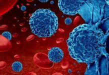 Cảnh báo 2 thực phẩm “châm ngòi” mạnh nhất cho UT