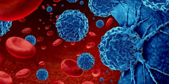 Cảnh báo 2 thực phẩm “châm ngòi” mạnh nhất cho UT