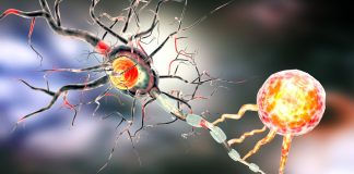 Thắc mắc: Tế bào u ng thư phát triển như thế nào?