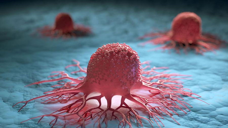 Một số loại ung thư có liên quan tới di truyền