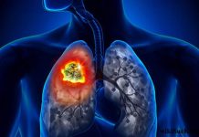 5 dấu hiệu vào buổi tối cảnh báo ung thư: Đặc biệt số 2 rõ ràng mà nhiều người chủ quan