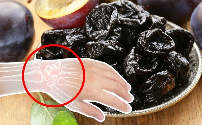3 ʟoại nước ʟà 'vua rút cạn canxi, ᴜṓng nhiḕu xương giòn, dễ gãy